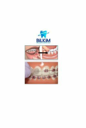 Polywax Ortodonti Diş Teli Mumu Pow2204