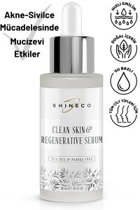 Me Shine Akne Karşıtı Bakım Serumu 30 ml