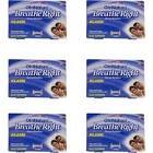 Otrinatura Breathe Right Klasik 6'lı