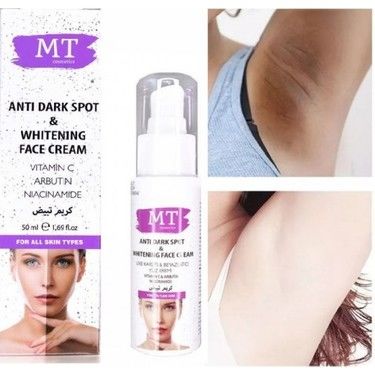 Nana Mt Cilt Beyazlatıcı Krem 100 ml