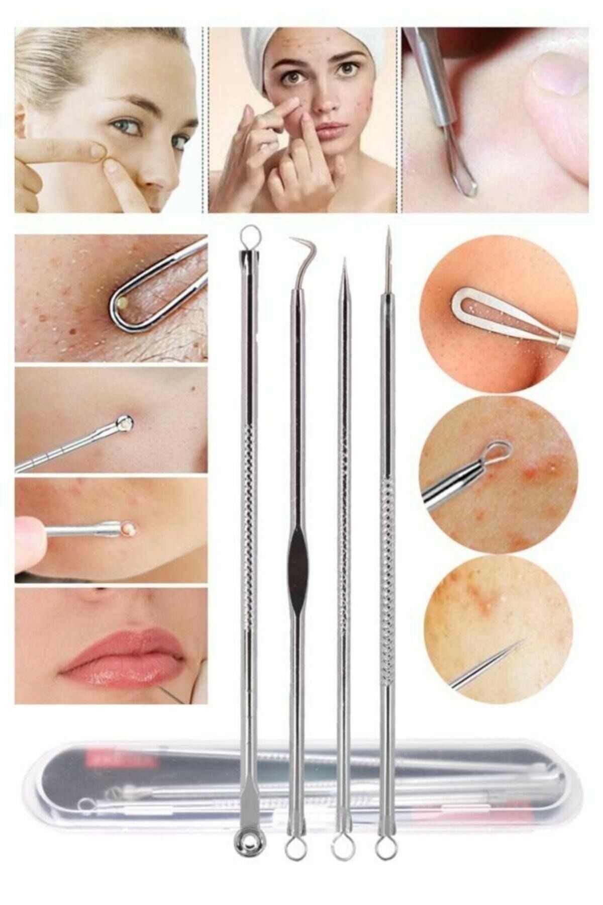 Beauty Make Up Tools Akne Siyah Nokta Temizleme Komedon Aleti